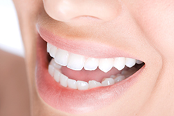 teeth-whitening